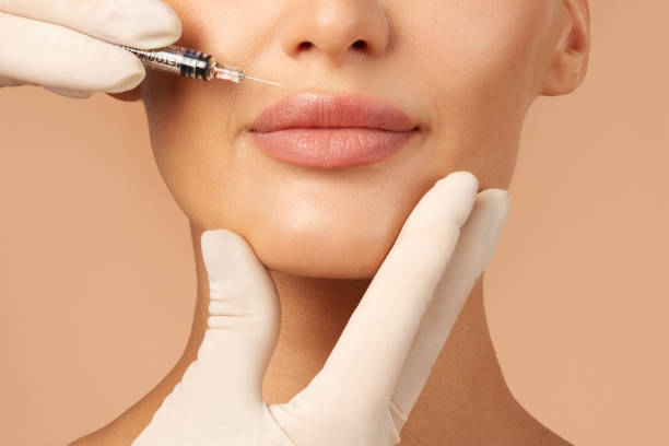 Lip Fillers